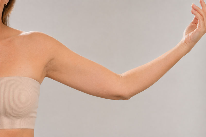Arm lift consultation