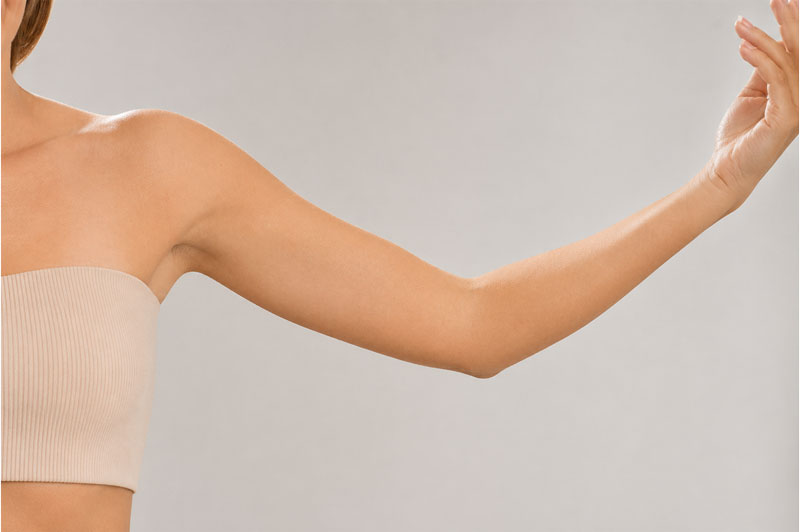 Arm liposuction and Renuvion consultation