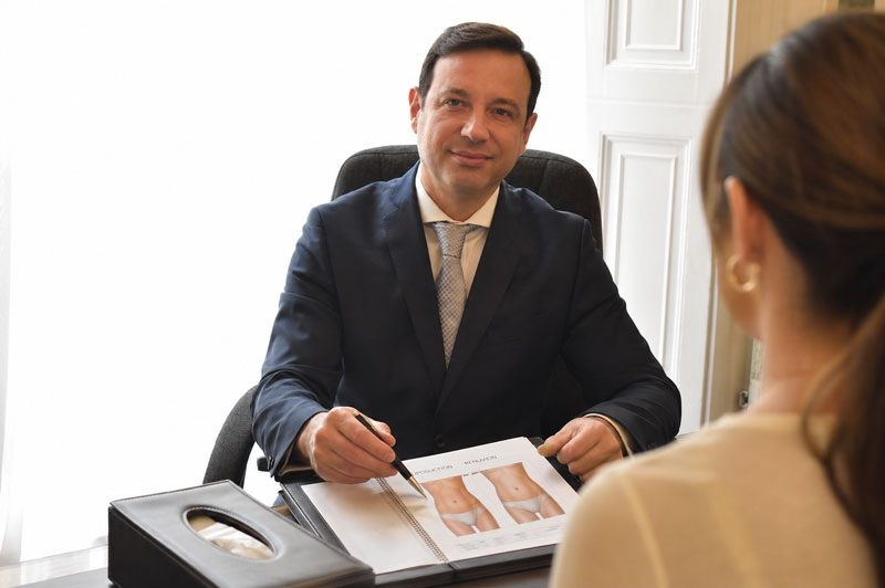 Abdominal liposuction and Renuvion consultation