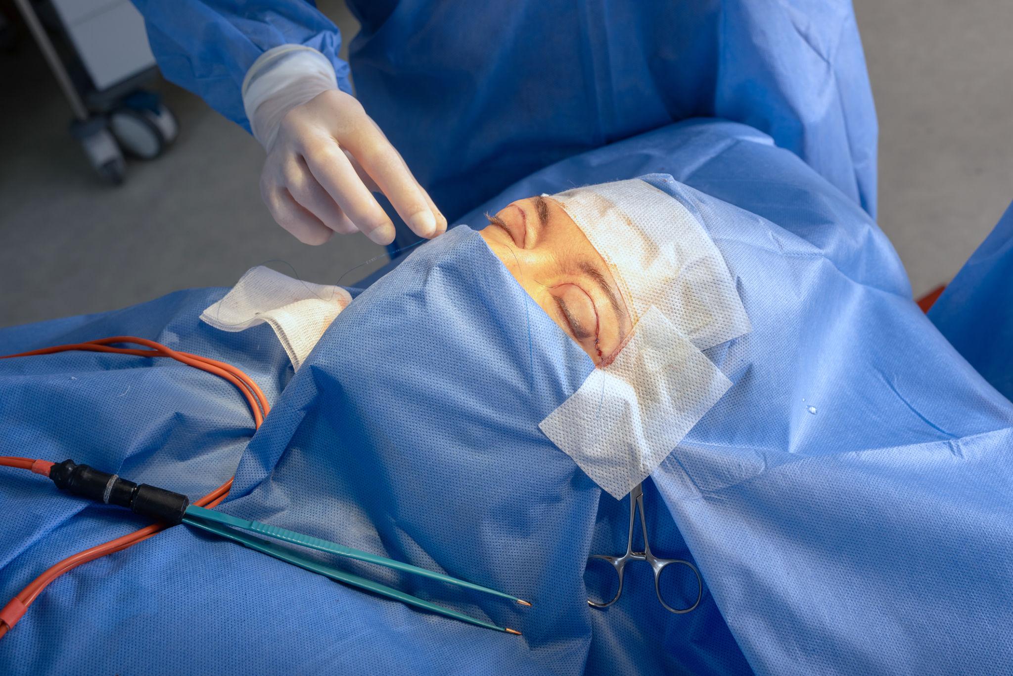 Upper blepharoplasty consultation focusing on the eye area
